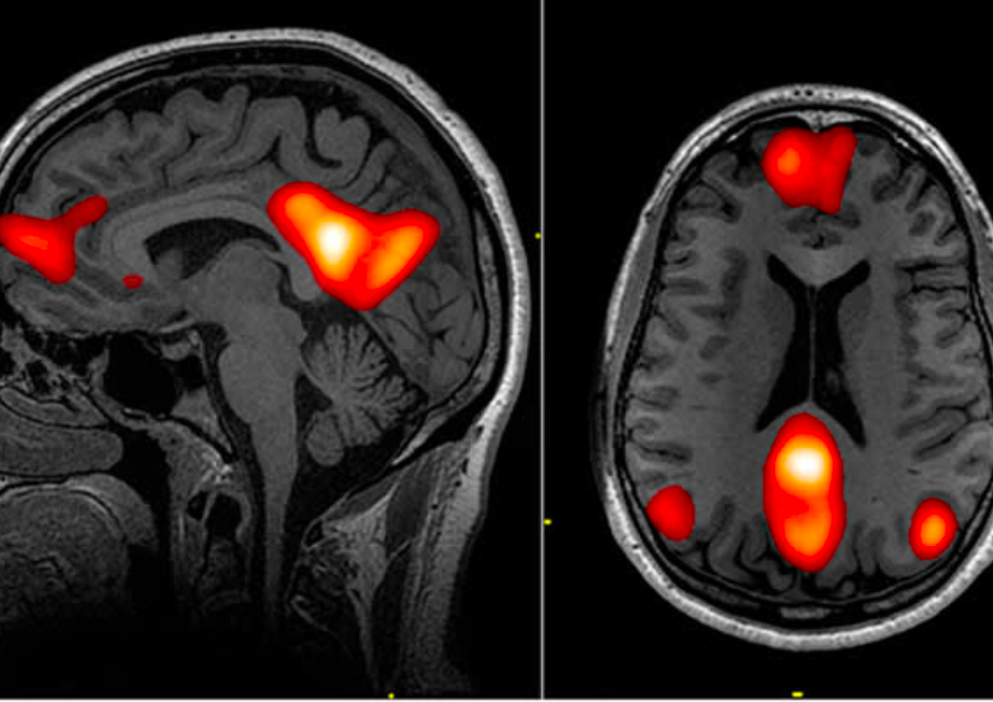 New Brain Science Shows Us a Sinister Effect of an Idle Mind